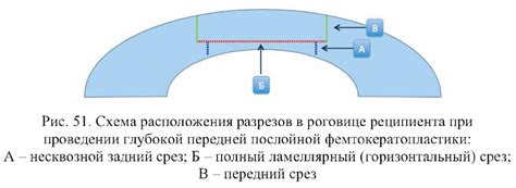 Риски при проведении разрезов