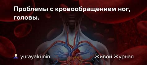 Серьезные проблемы с кровообращением