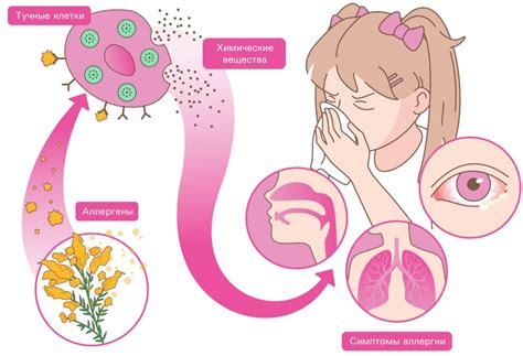 Симптомы аллергической реакции
