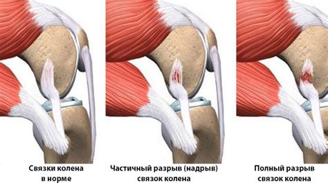 Симптомы и диагностика болезней суставов колен