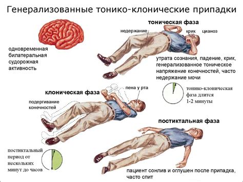 Симптомы и причины судороги с левой стороны шеи