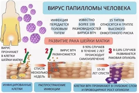 Симптомы и процесс самовыпадения папилломы