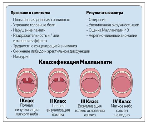 Синдром обструктивного апноэ сна (СОАС)