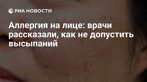 Советы по профилактике аллергической сыпи на лице