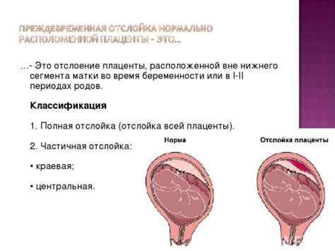 Современные причины и негативные последствия родов в поле