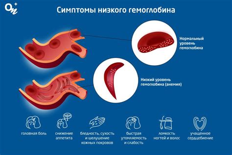 Способы устранения низкого уровня гемоглобина