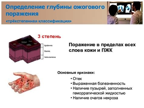 Травматические повреждения кожи