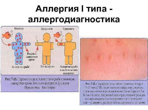 Увеличение числа аллергических реакций у населения