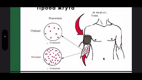 Улучшение кроветворной системы