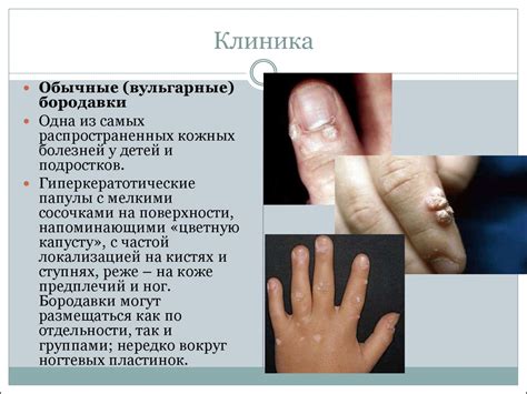 Ухудшение состояния кожи и слизистых оболочек