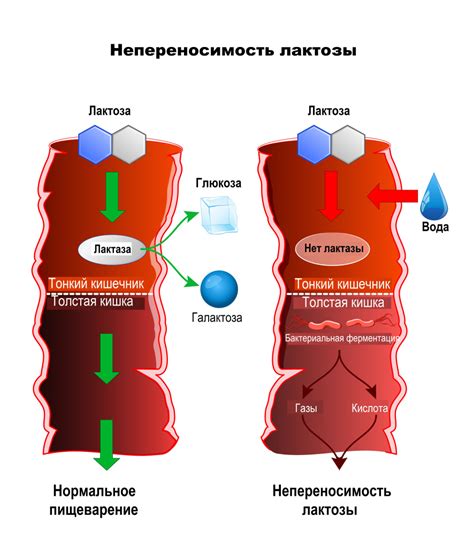 Ферменты и непереносимость