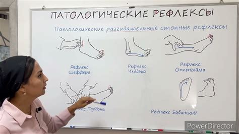 Физические рефлексы