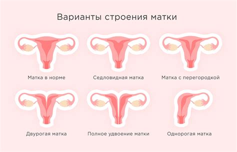 Физическое развитие и пространство в матке