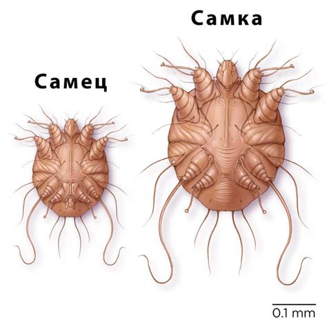 Чесоточный клещ и его особенности
