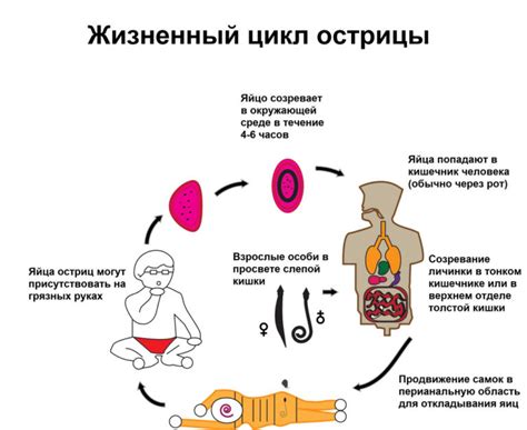 Что такое энтеробиоз?