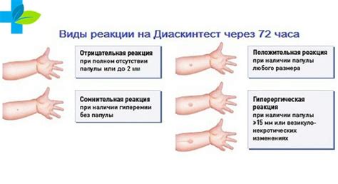  Как долго не мочить руку после прививки? 