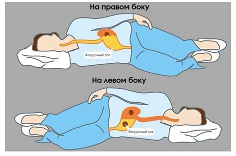  Как избежать проблем с режимом сна? 