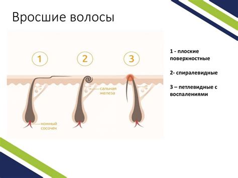  Рекомендации по уменьшению роста волос после депиляции воском 